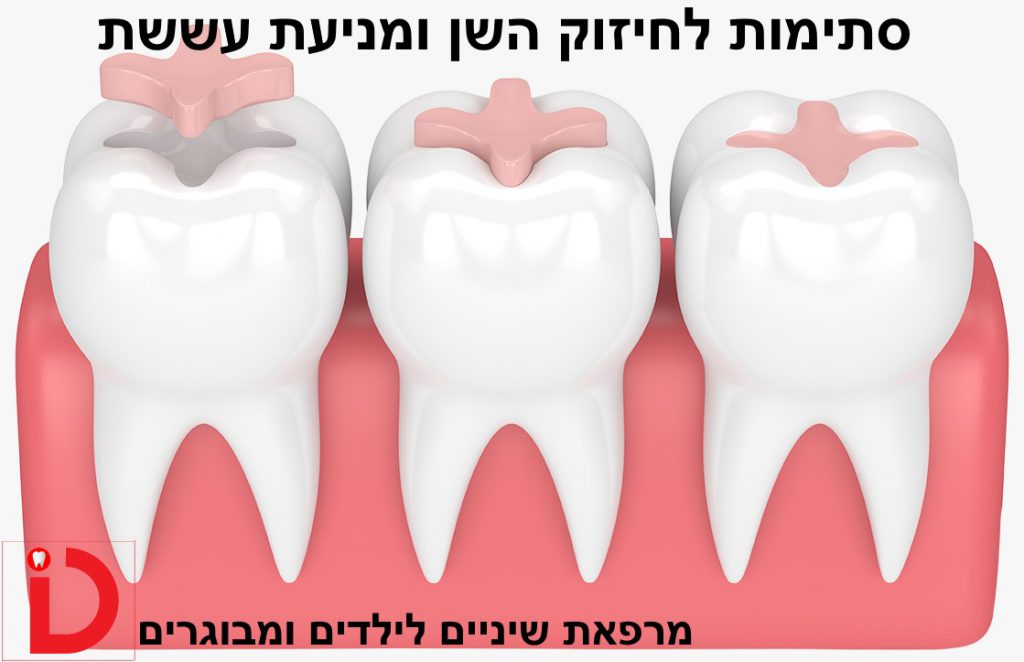 סתימה