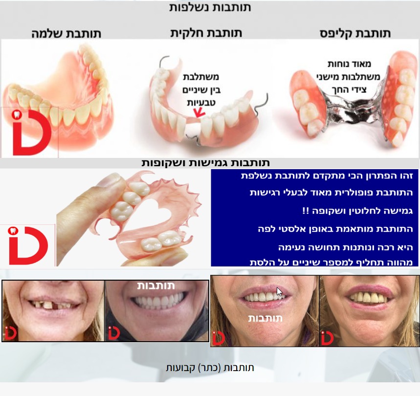 תותבות